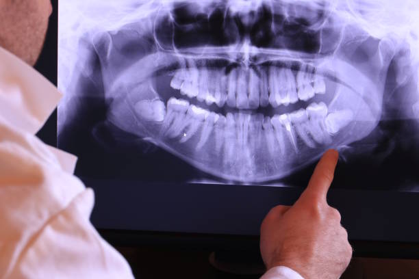 Best Emergency Broken Tooth Repair in Manhasset, NY